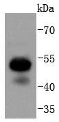 RUNX1+RUNX2+RUNX3 Rabbit mAb