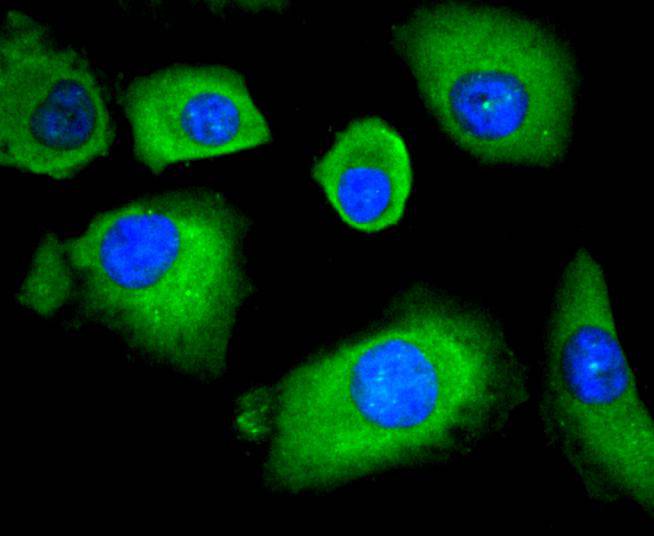 HDAC4 Rabbit mAb