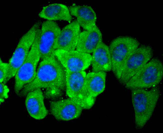 HDAC4 Rabbit mAb