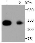 HDAC4 Rabbit mAb