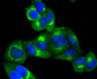 TRK fused gene Rabbit mAb