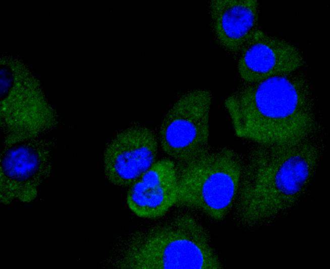 TRK fused gene Rabbit mAb