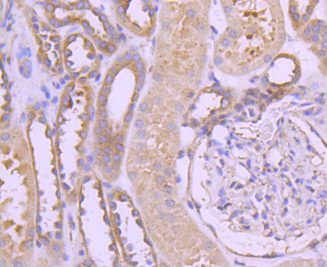 TRK fused gene Rabbit mAb