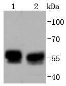 TRK fused gene Rabbit mAb