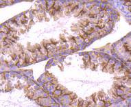 Stromal interaction molecule 1 Rabbit mAb