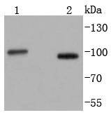 Stromal interaction molecule 1 Rabbit mAb