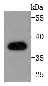 AMPK beta 1 Rabbit mAb