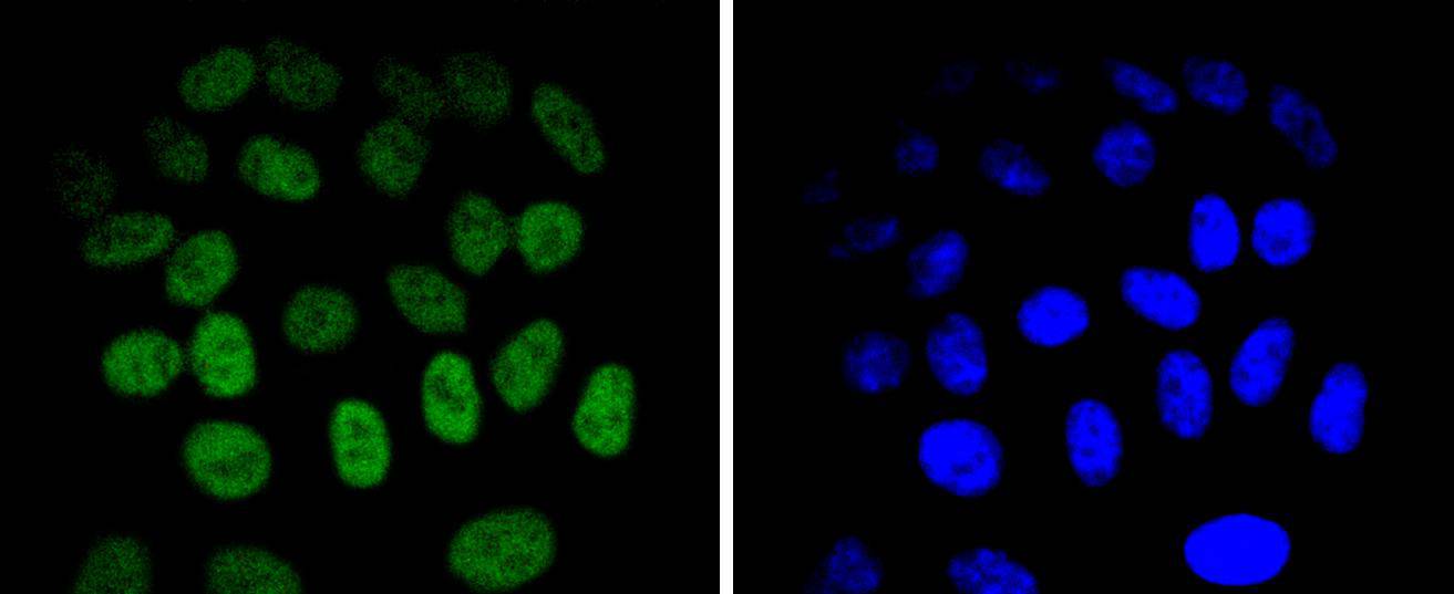 JunB Rabbit mAb