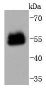 PAX6 Rabbit mAb