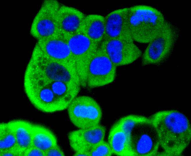 MEK2 Rabbit mAb