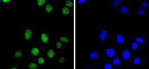 PAX8 Rabbit mAb