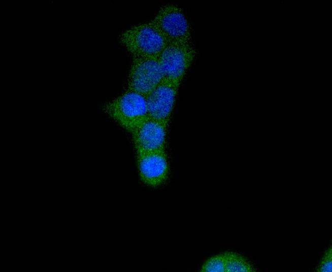 FGFR1 Rabbit mAb