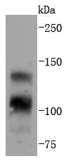 FGFR1 Rabbit mAb