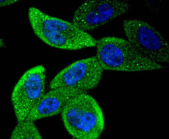 STAT5b Rabbit mAb