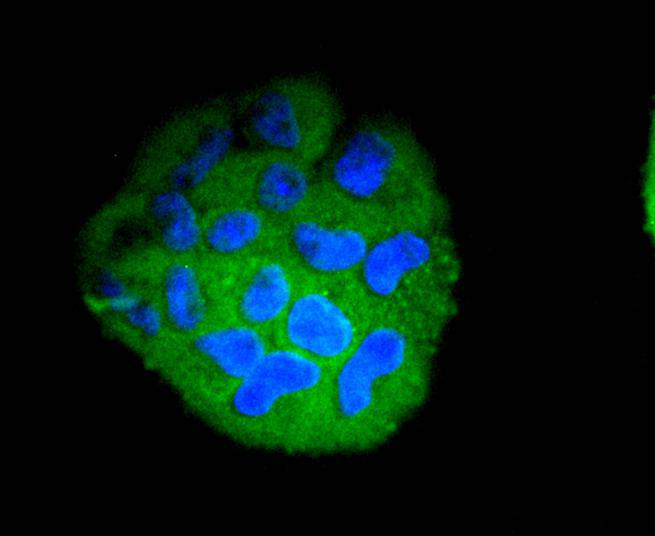 STAT5b Rabbit mAb