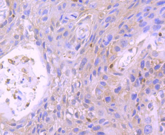 STAT5b Rabbit mAb