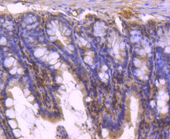 STAT5b Rabbit mAb