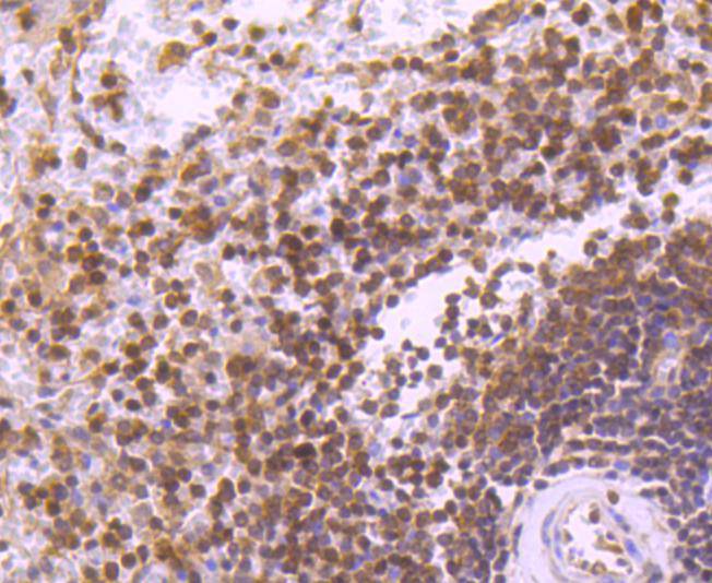 STAT5b Rabbit mAb