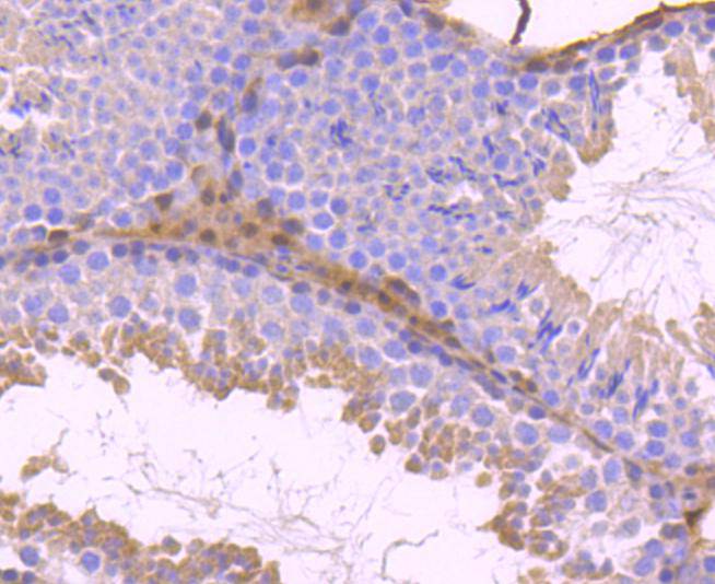 STAT5b Rabbit mAb