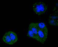 DYNLL1 Rabbit mAb