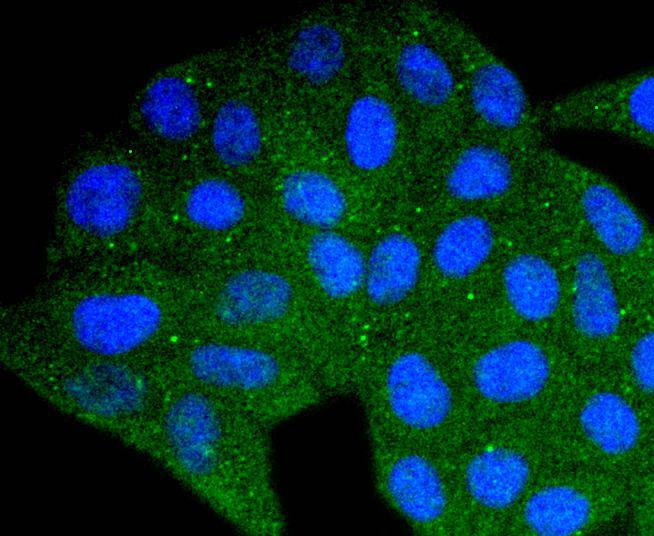 DYNLL1 Rabbit mAb