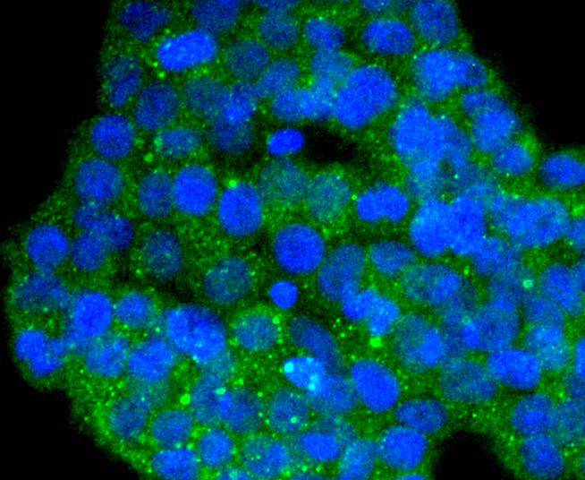 DYNLL1 Rabbit mAb