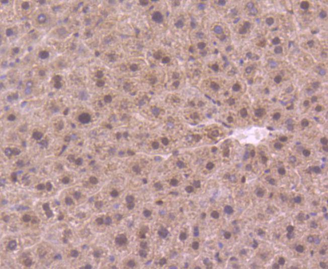 DYNLL1 Rabbit mAb