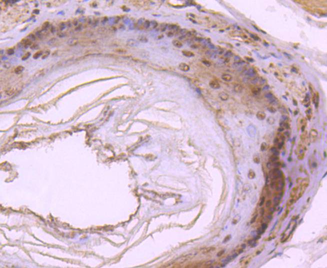 DYNLL1 Rabbit mAb