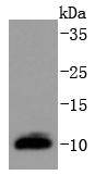 DYNLL1 Rabbit mAb