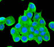 Tyrosine Hydroxylase Rabbit mAb