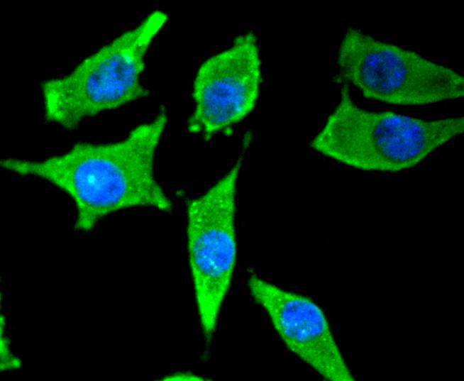 Tyrosine Hydroxylase Rabbit mAb