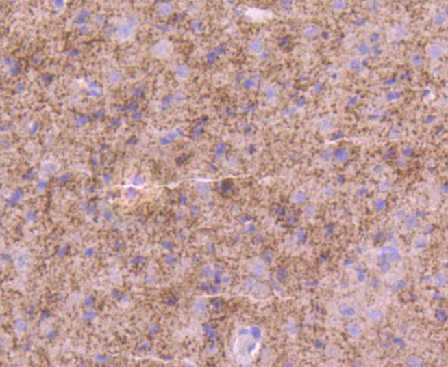 Tyrosine Hydroxylase Rabbit mAb