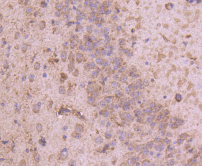 Tyrosine Hydroxylase Rabbit mAb