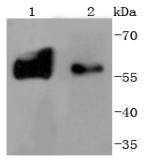 Tyrosine Hydroxylase Rabbit mAb