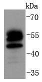 FOXO4 Rabbit mAb