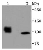 HDAC7 Rabbit mAb