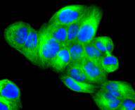 JNK3 Rabbit mAb