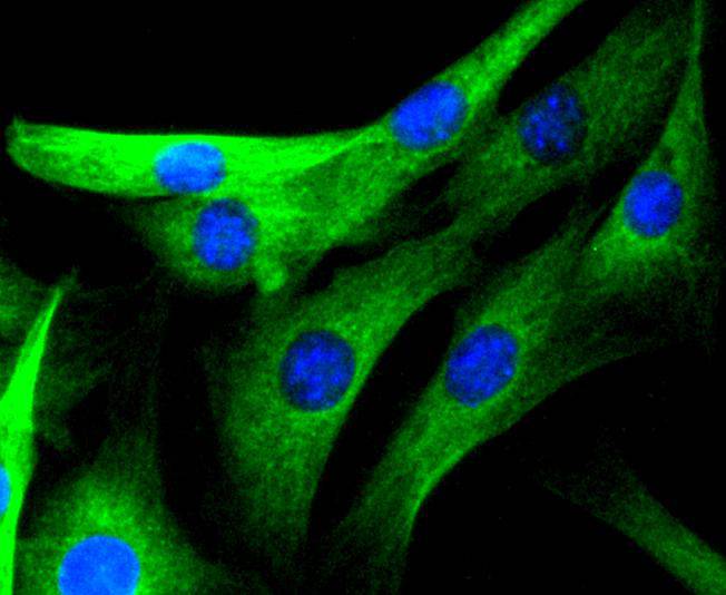 JNK3 Rabbit mAb