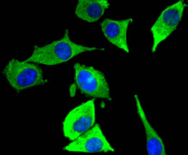 JNK3 Rabbit mAb