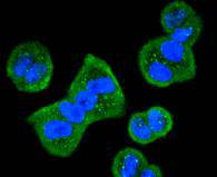 HDAC10 Rabbit mAb