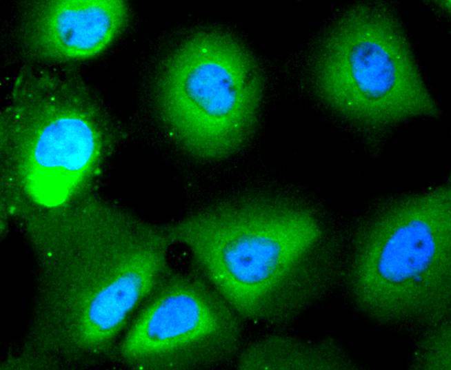 HDAC10 Rabbit mAb