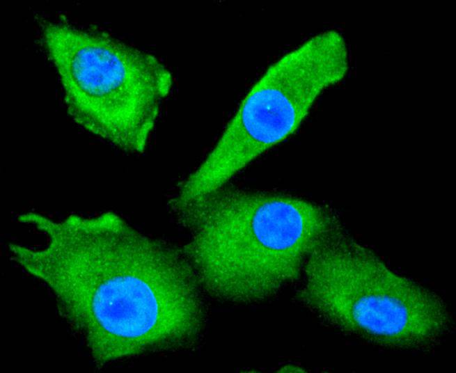 HDAC10 Rabbit mAb