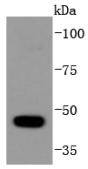 HDAC10 Rabbit mAb