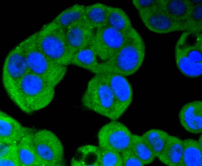 ERK5 Rabbit mAb