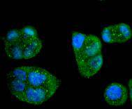 Caspase-8 Rabbit mAb