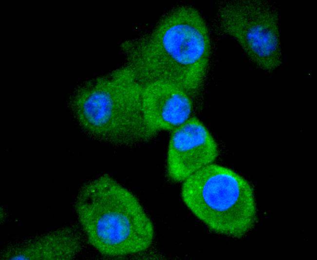 Caspase-8 Rabbit mAb