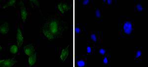 SOX11 Rabbit mAb