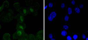 SOX11 Rabbit mAb