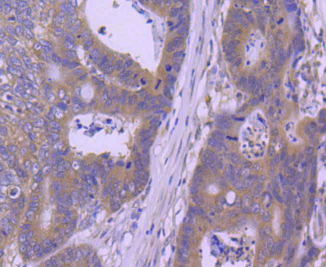 Hsp105 Rabbit mAb