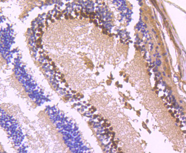 PAX6 Rabbit mAb